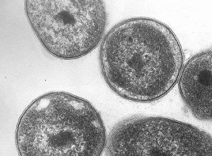 Methylocella silvestris