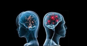 brain